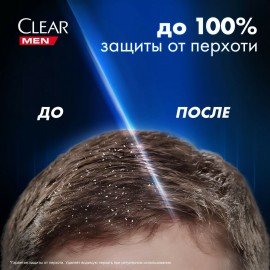 Шампунь против перхоти 610мл CLEAR, против выпадения волос, ш/к 94158